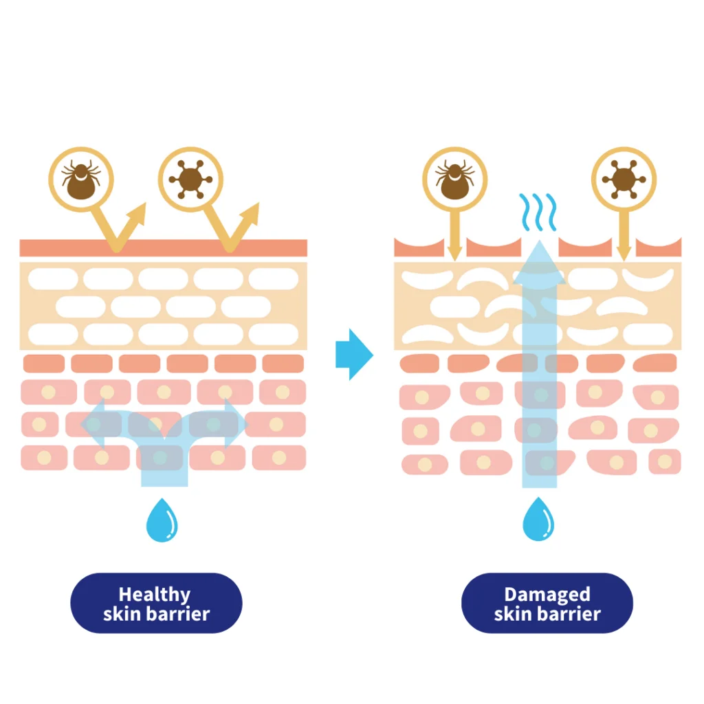 Healthy skin barrier vs damaged skin barrier