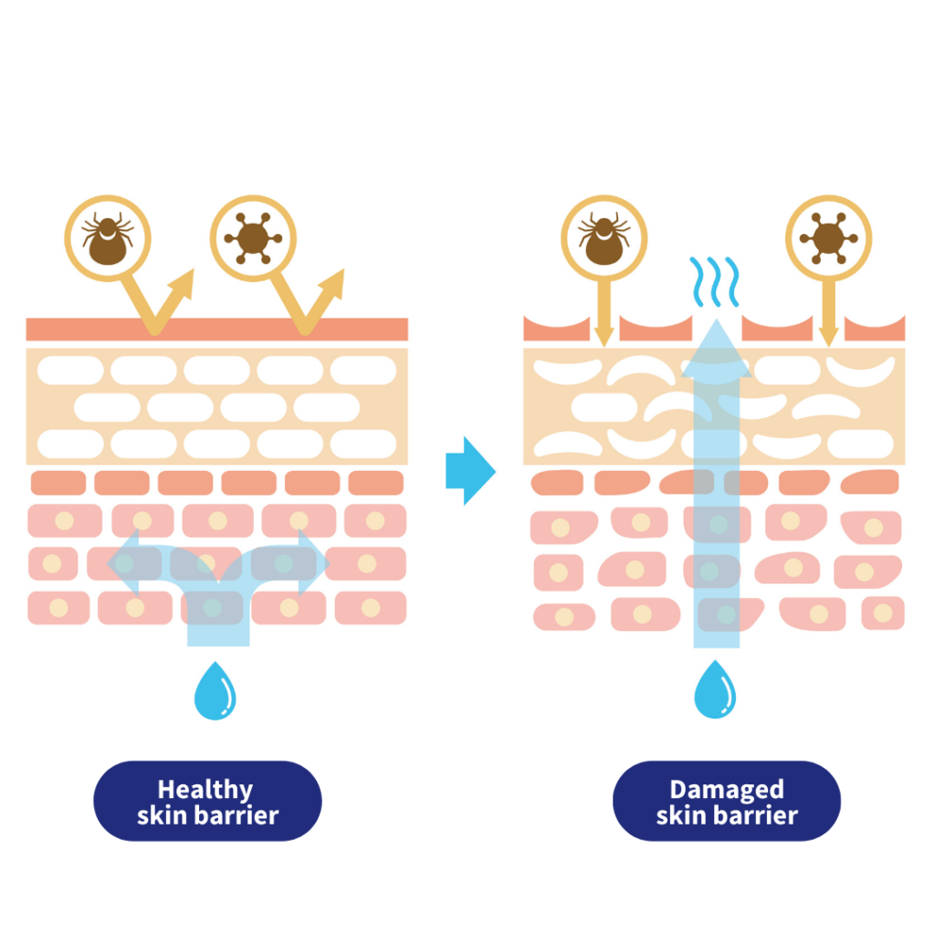 Strengthening skins barrier function