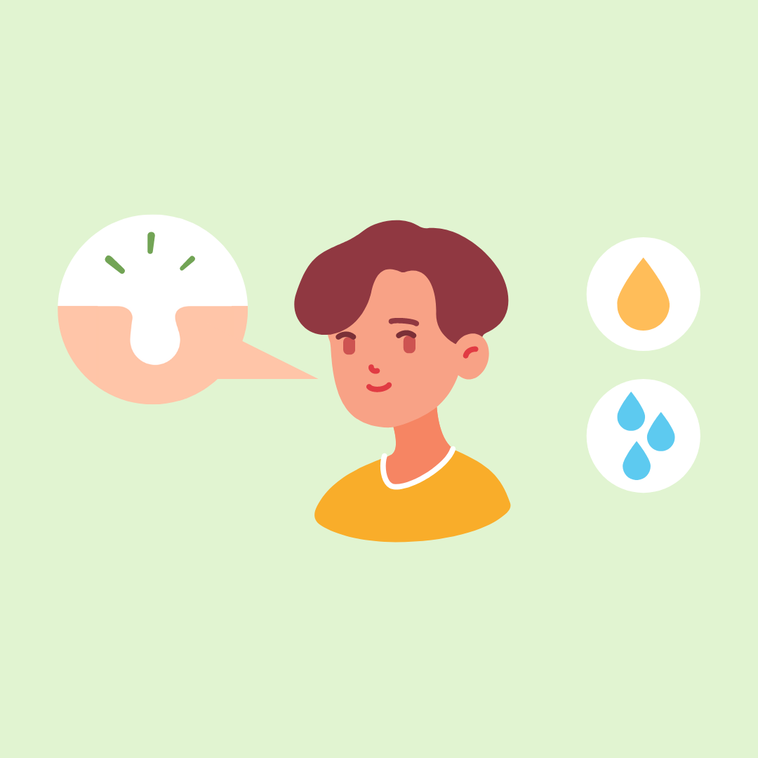 Myth vs. Fact Steam Opens Your Pores and Ice Closes Them Picky The