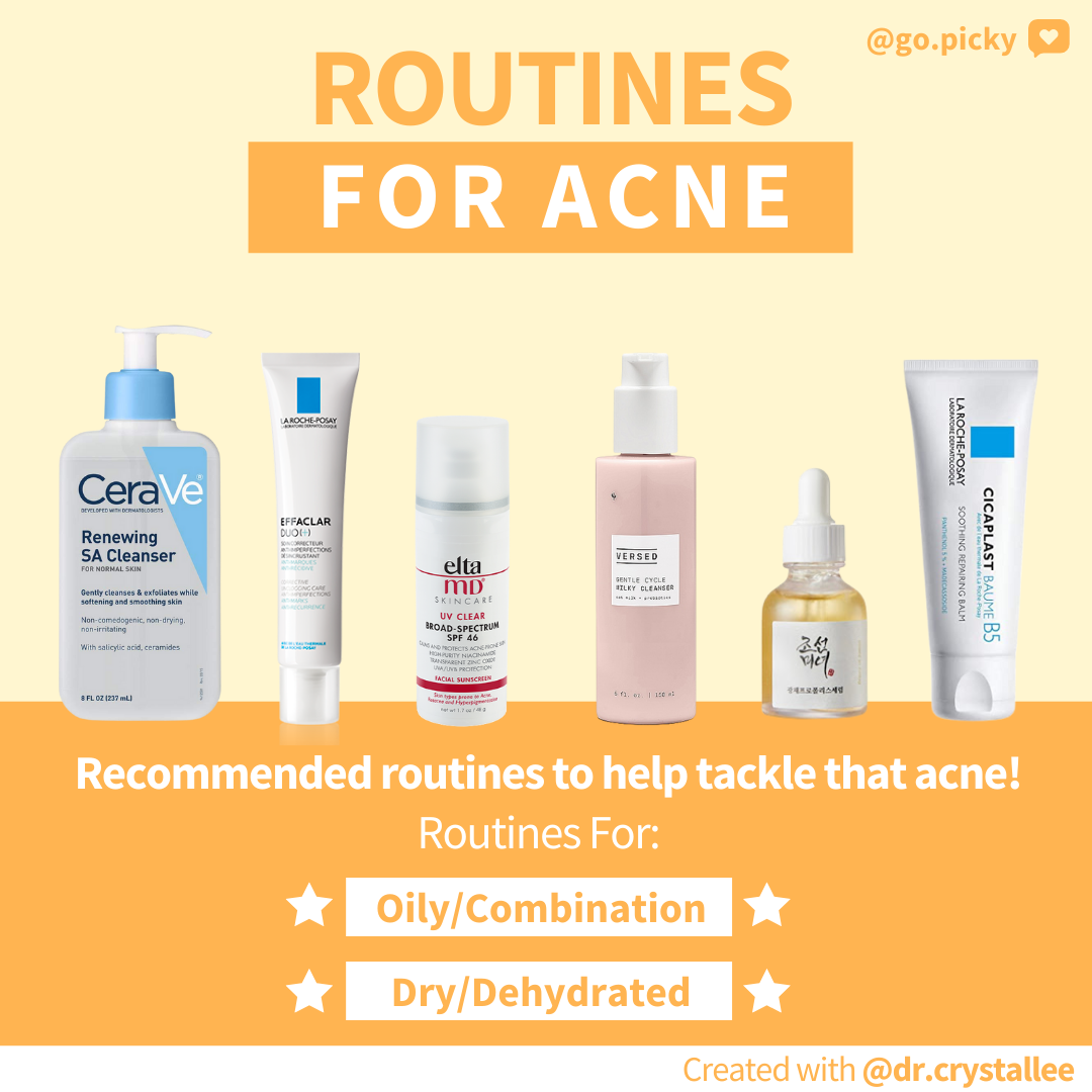 Acne Routines!